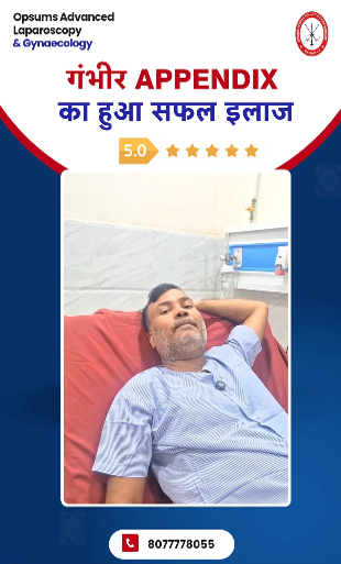 Critical-Laparoscopic-Appendectomy