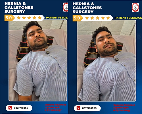 Single-Session-Hernia-Gallstone-Surgery-Patient-Testimonial