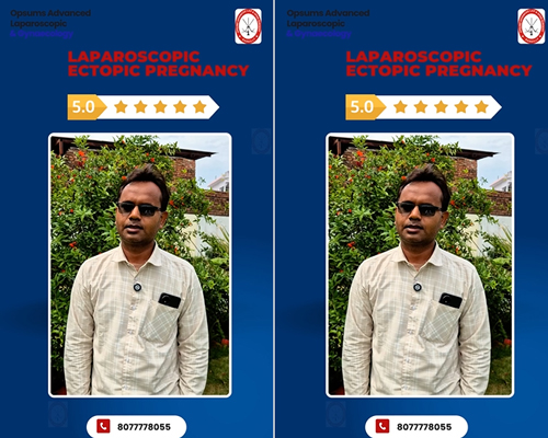 Successful-Laparoscopic-Ectopic-Pregnancy-Surgery-Patient-Family-Feedback